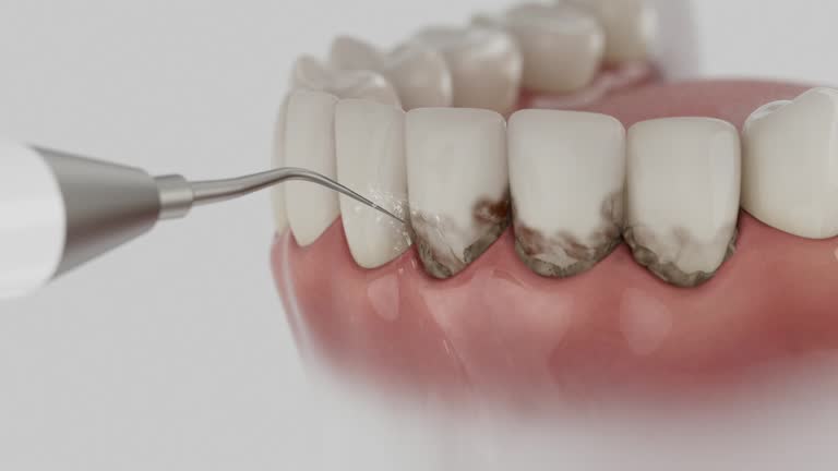 Trusted Teeth Cleaning And Checkup service in Bethlehem, WV - Dentist Open Now